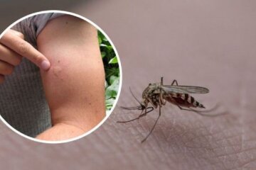 Під шкірою може оселитися “чужий” від одного укусу комара: як розпізнати небезпечну хворобу