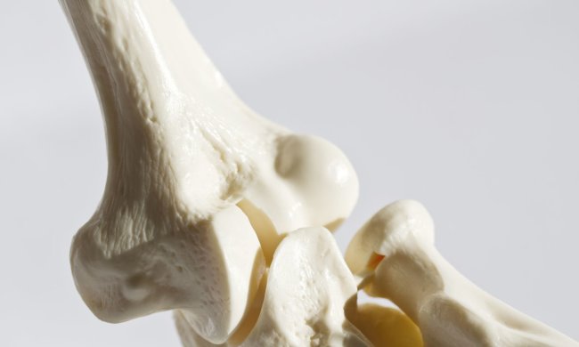 Генетики вийшли на "провокаторів" остеопорозу