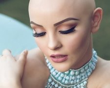 Сила духу: хворіюча на рак дівчина розчулила мережу (ФОТО)