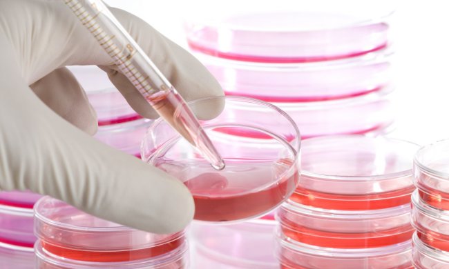 Мікробіологи відкрили генетичне "полювання" на вовчанку