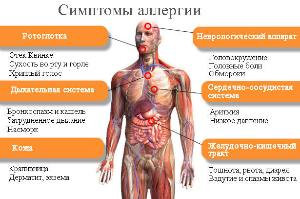 ᐈ Пищевая аллергия: симптомы и лечение ~【Киев】