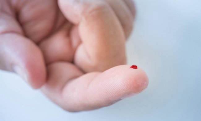 Мнение эксперта: почему бумажные порезы настолько болезненны