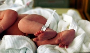 Лікарі розділили немовлят зі зрощеними грудьми 