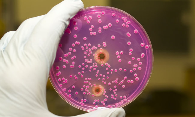 Кишковий грибок стирає пам'ять: чому так відбувається