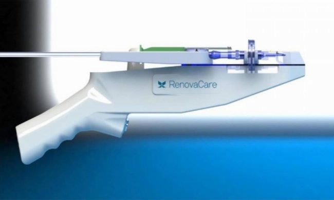 Медики лікуватимуть опіки пістолетом зі стовбуровими клітинами