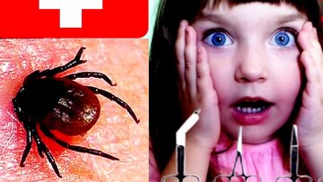 Болезнь Лайма