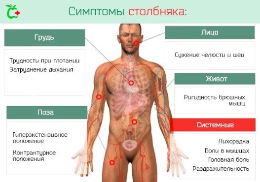 Правець - що це за захворювання?