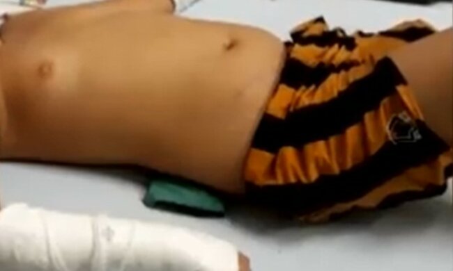 В Мукачево школьник на физкультуре переломал позвоночник, скриншот