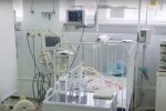Маленьку принцесу, яка "пірнула" у ванну з окропом, рятують у реанімації: "Витримала чотири операції"
