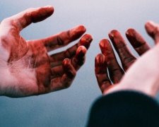 На Дніпропетровщині дитині розірвало руки при грі з запалом гранати