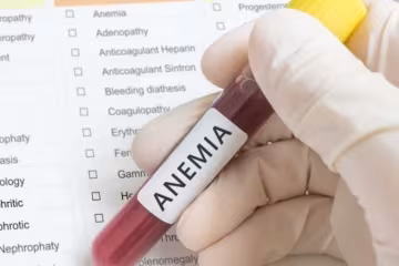 Дефіцит заліза в організмі, анемія, зображення з вільних джерел