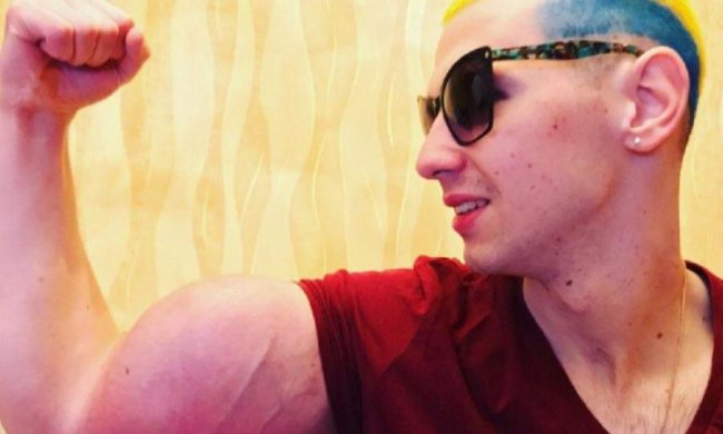 Дагестанский танцюрист спробував відірвати руки-базуки: фото