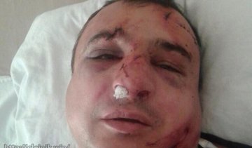 Жестоко избили поднявшего флаг РФ на здание ОГА сепаратиста Клинчаева (видео)