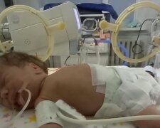новорожденной девочке нужна операция, фото: Facebook Мама и младенец