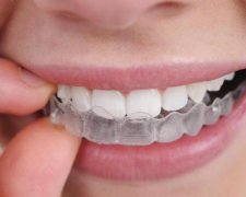 3D-друк зробить гарну посмішку доступною для всіх