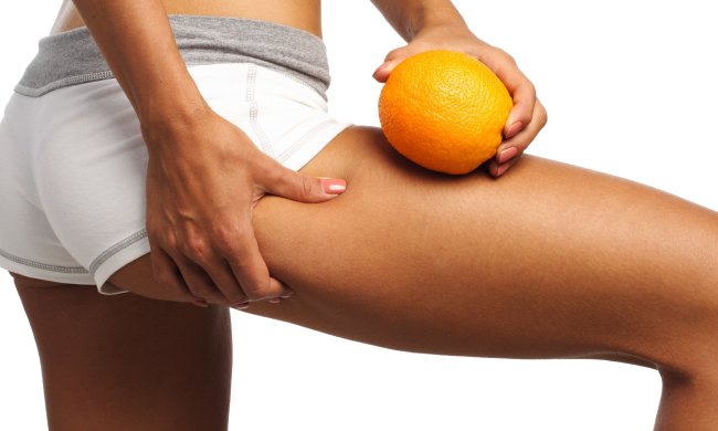 Позбутися целюліту - легко: дієтолог розкрив головний секрет