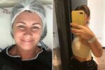 Зрештою Клер довелося видалити імплантати