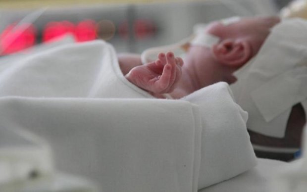 Врачи шокированы! Новорожденный появился на свет с гениталиями на спине
