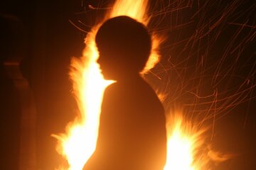 Ігри дітей з бензином закінчилися трагедією для 8-річного Кирилка: все тіло в опіках, мати благає про допомогу