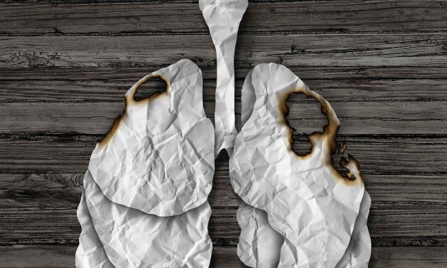 Від грудей до легких: генетики запропонували лікувати пухлини перевіреним способом