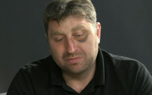 Ради забавы луганскому депутату подкинули отрезанную голову