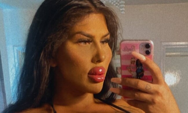 Британка збільшує свої губи кожні два місяці: хейтери називають її монстром, але їй байдуже