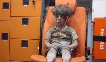 Окровавленный сирийский мальчик всколыхнул весь мир (ВИДЕО 18+) 