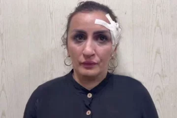 Повідомляється, що жінка продала свого новонародженого сина, щоби заплатити за пластику носа