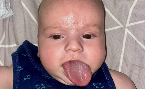 Хлопчик з довгим язиком, фото: Facebook