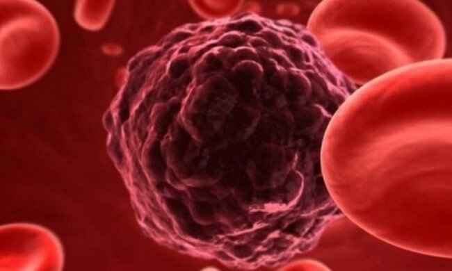 Вчені знайшли спосіб зупинити ракову пухлину