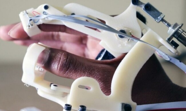 Роборукавичка діагностуватиме ДЦП у дітей