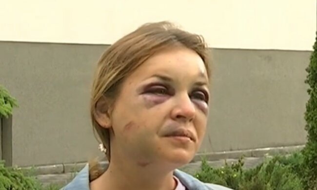 Жертва нападу у поїзді, скріншот