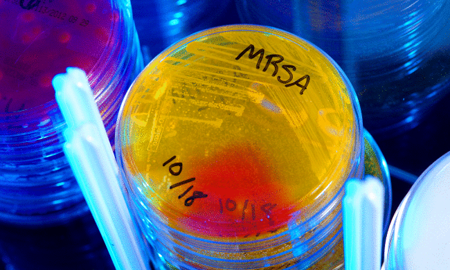 Мікробіологи навчилися передбачати спалахи суперінфекцій
