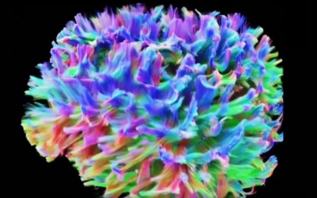 Ученые показали самое детальное изображение мозга человека