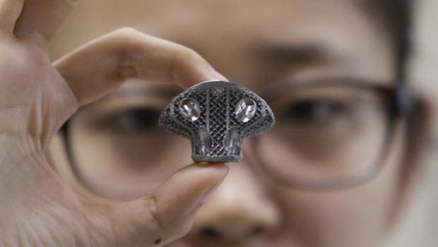 В Китае впервые имплантировали позвонок напечатанный на 3D-принтере