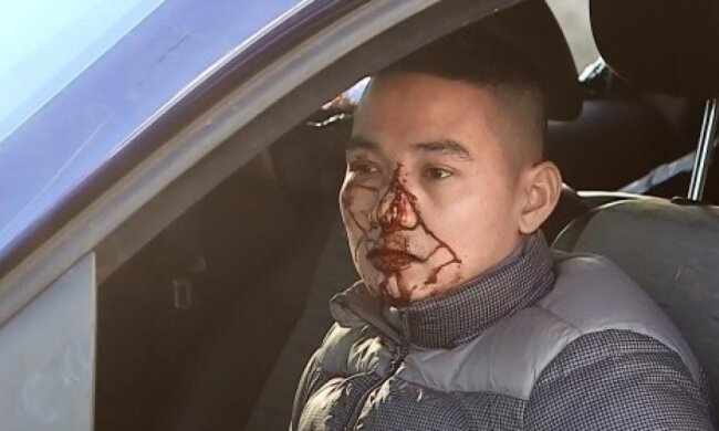 На валютників-в'єтнамців зі «Сьомого кілометра» напали в Одесі  (фото, відео) 