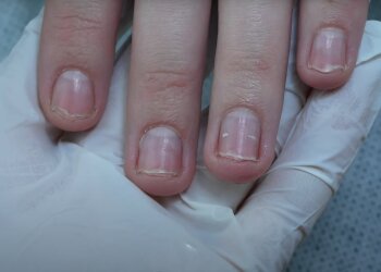 Проблемы с ногтями, скриншот: Youtube