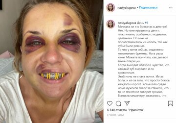 Публікація Анастасії Лугової, скріншот: Instagram