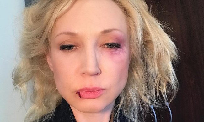 Кристина Орбакайте