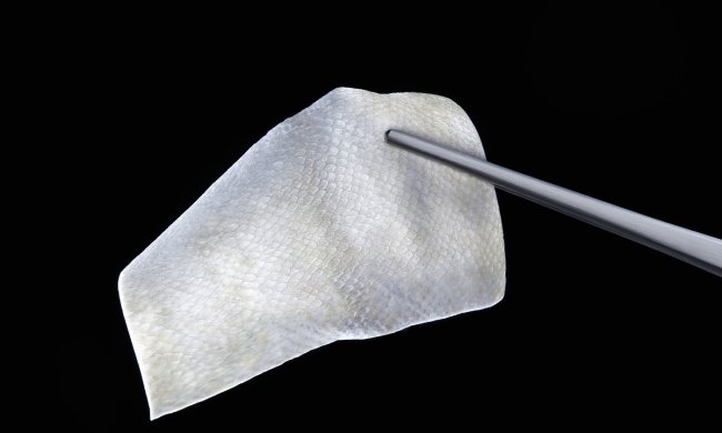 Бинти з тілапії: як риб'яча шкіра зцілює опіки