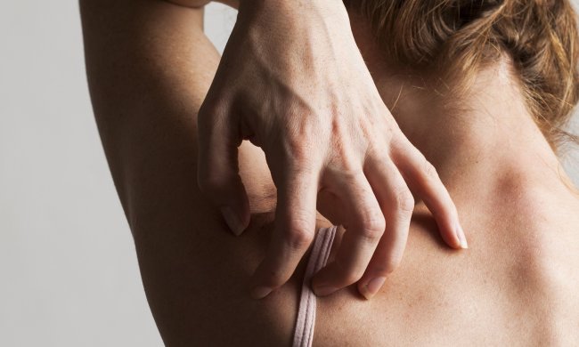 Свербіж: ось чому ми чухаємося