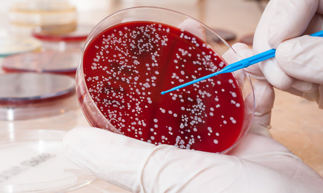 Медики запропонували діагностувати рак по-новому