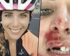 Під час стрибка з тарзанки дівчина втратила зуби: відео