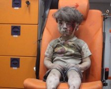 Окровавленный сирийский мальчик всколыхнул весь мир (ВИДЕО 18+)