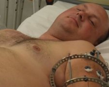 Українські лікарі відростили воїну АТО руку