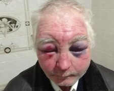 На Буковине избили 63-летнего прихожанина