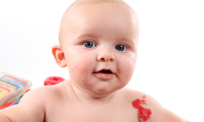 Не тільки рак: наскільки небезпечні дитячі родимки