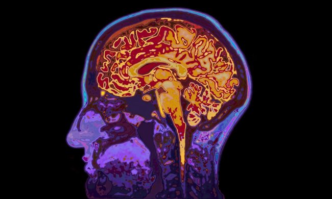 Исследование: слабоумие одолели всего одной молекулой