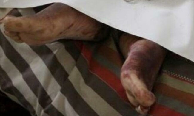 Удар тока убил мужчину в Хмельницкой области 