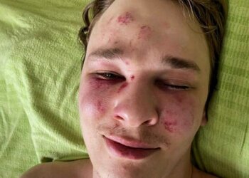 Парень пытался покончить с собой после задержания ТЦК / фото: скриншот Instagram